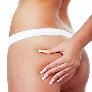 Cellulite - Traitements d'entretien